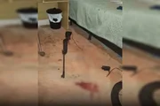 Criança é baleada na cabeça com arma de chumbinho Criança é baleada na cabeça com arma de chumbinho