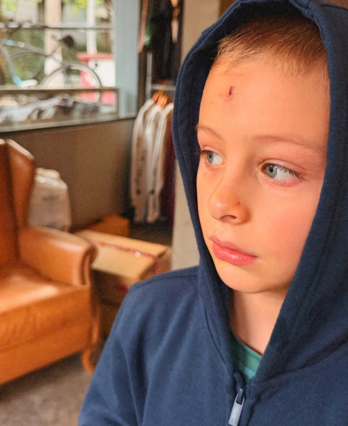Shantal Verdelho mostrou o filho mais velho com o machucado na testa Shantal Verdelho mostrou o filho mais velho com o machucado na testa