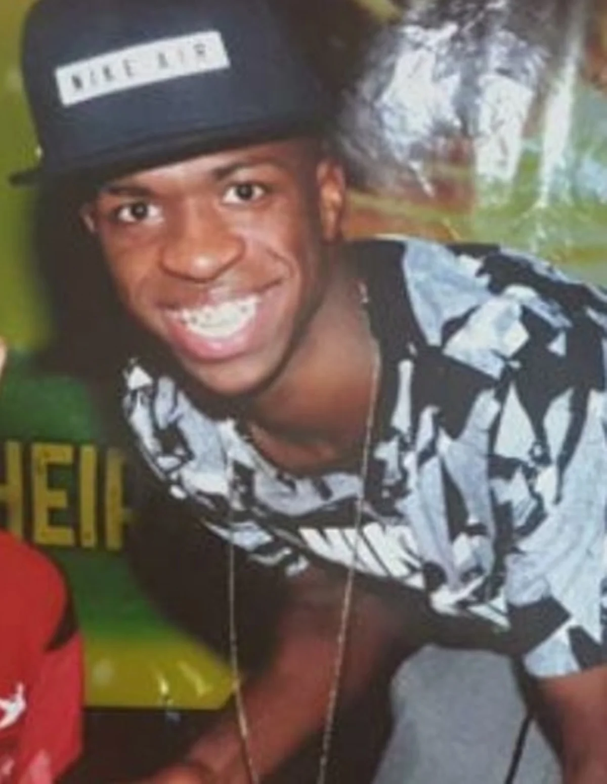 Vini Jr. antes de procedimentos estéticos Vini Jr. antes de procedimentos estéticos