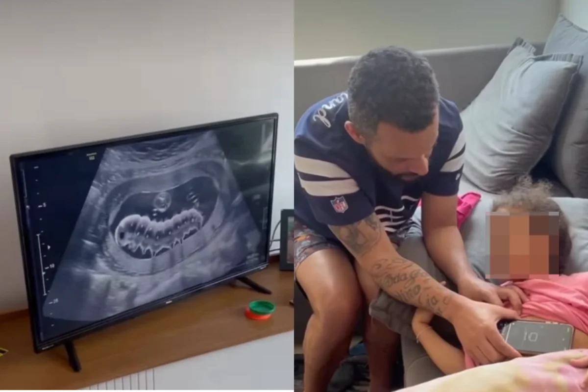 Trend do "bicho na barriga" pode afetar a confiança da criança