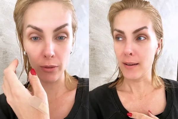 Ana Hickmann sofre acidente doméstico grave: “Cena mais assustadora”