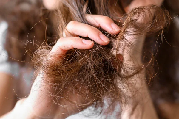 scab hair - Metrópoels