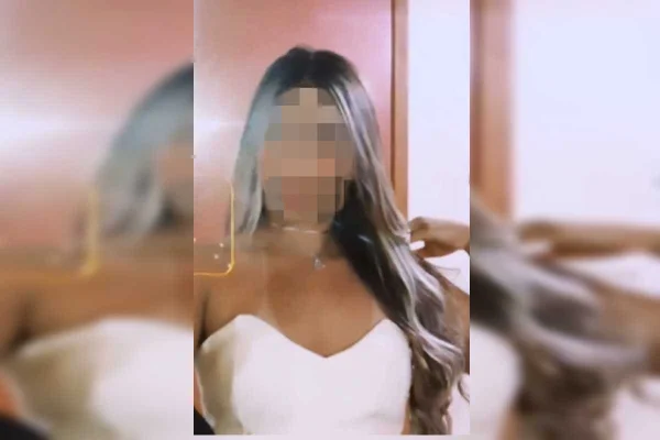 Escalpelada por kart iria escolher vestido de formatura nesta semana