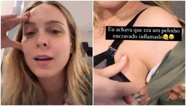 Especialista esclarece dúvidas sobre terceira mama de Tata Estanieicki