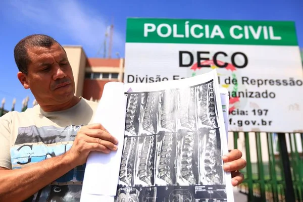 Máfia das Próteses: dois médicos respondem a processos na Justiça