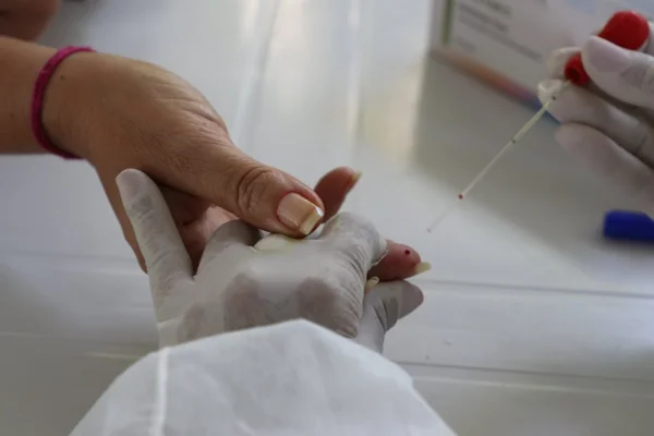 Pacientes podem ter trombose até um mês após se recuperarem da Covid