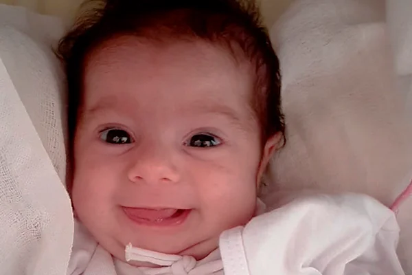A bebê Isabela já enfrentou 3 cirurgias: a 1ª, na barriga da mãe