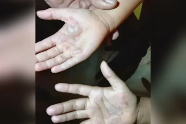 mae queima maos filhas rio verde goias
