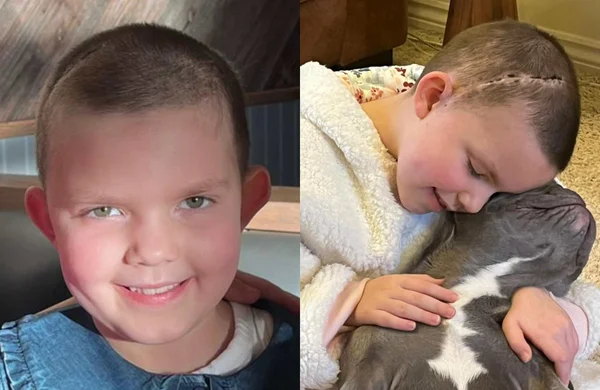 Darcey Perring teve traumatismo craniano após bater a cabeça em parquinho - Metrópoles