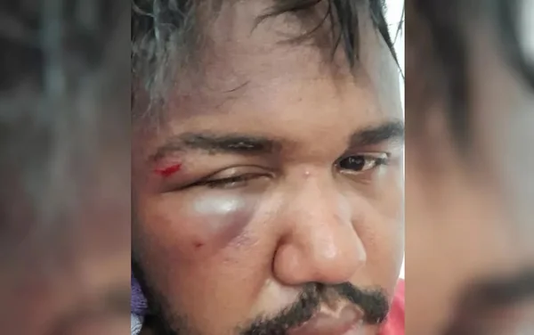 goias jovem agredido em supermercado