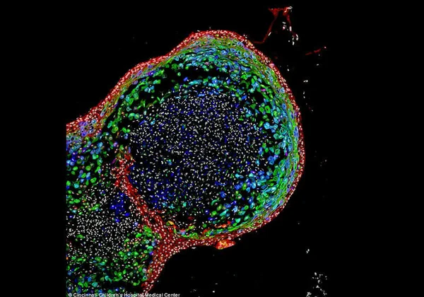 Cientistas criam esôfago humano a partir de células-tronco