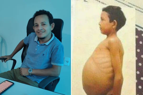 Foto mostra Paulo Ricarte, homem que teve a doença de Guacher