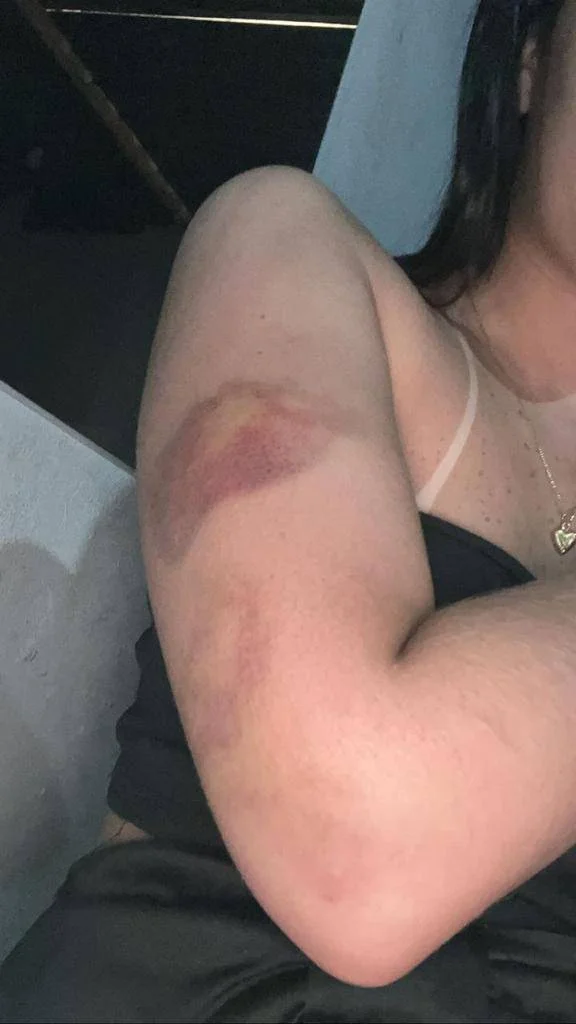 Jovem que gravou sua morte tinha fotos de lesões por agressões. Vídeo