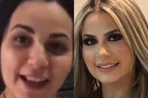 Antes e depois: Deolane Bezerra abre o jogo sobre cirurgias plásticas