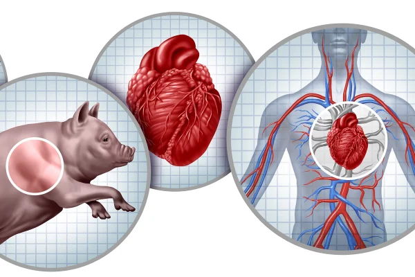 Ilustração mostra um porco, um coração e um corpo humano com o coração destacado - Metrópoles