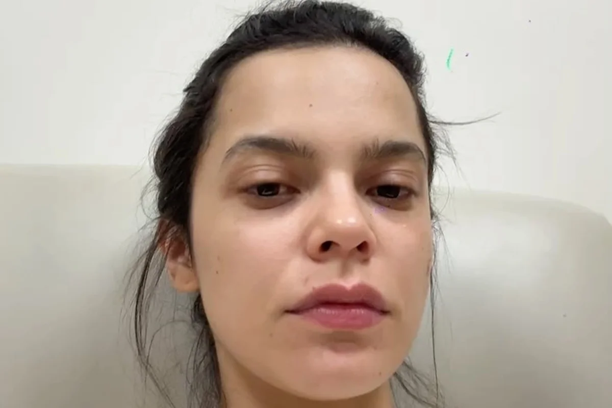 A ex-BBB Mayla Araújo no hospital