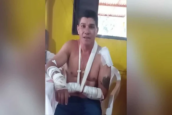 Imagem colorida, homem que diz ter sido atacado por onça em MS - Metrópoles