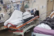 Segundo profissionais de saúde, faltam padioleiros, enfermeiros e técnicos de enfermagem  