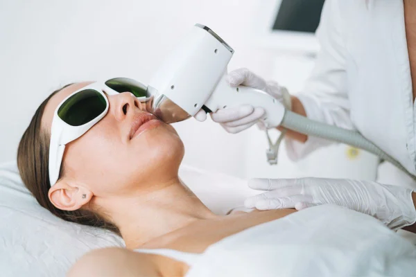 Depilação a laser facial elimina pelos indesejados de forma segura