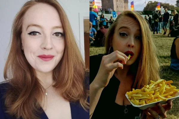 Foto mostra a inglesa Amy Francis-Smith que teve alergia tão grave que só podia se alimentar com 4 coisas