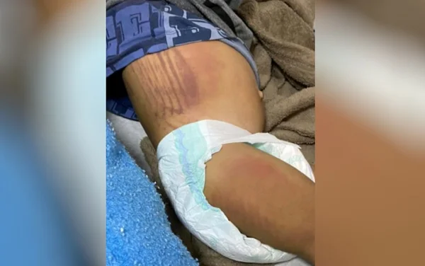 goias bebe agredido cristalina