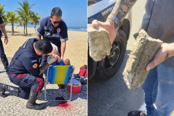Imagem colorida de um homem ferido na cabeça após ser alvo de pedradas por um homem em situação de rua - Metrópoles