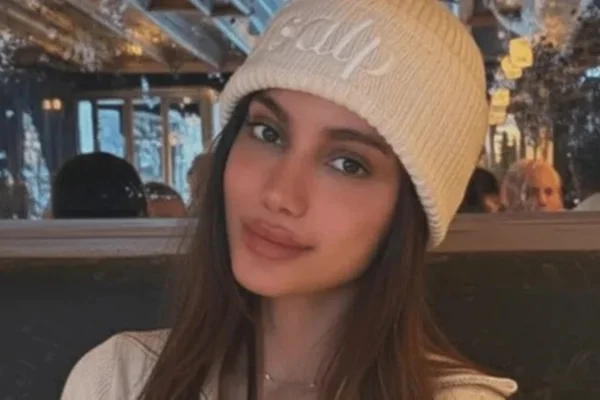 Anitta aparece com rosto diferente e web reage. Veja antes e depois