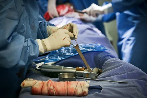 médicos realizando transplante