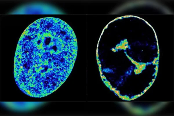 Enquanto o DNA da célula à esquerda está em seu estado natural, a célula à direita é apresentada oito horas após a infecção do vírus do herpes, com grande parte do genoma humano compactado, abrindo espaço para o vírus realizar seu processo de reprodução. Metrópoles
