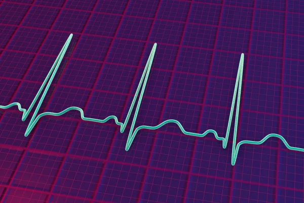 Imagem mostra um eletrocardiograma de pessoa com taquicardia - Metrópoles