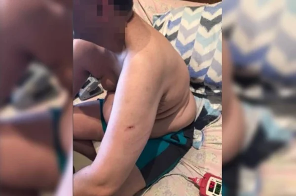 homem ferido sentado na cama