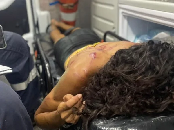mulher-trans-agressao-joao-pessoa-metropoles