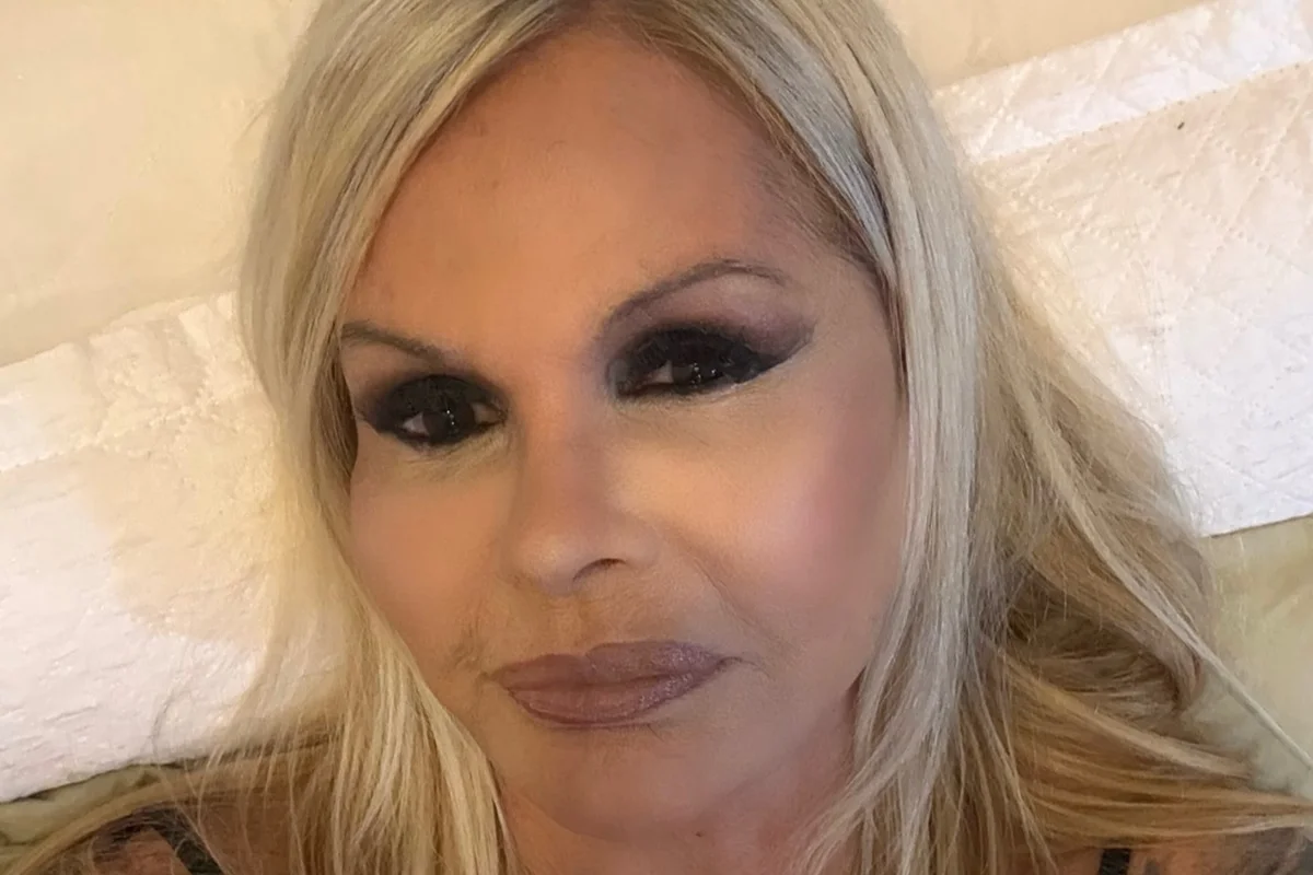 Monique Evans fez uma cirurgia no rosto no fim de semana Monique Evans fez uma cirurgia no rosto no fim de semana