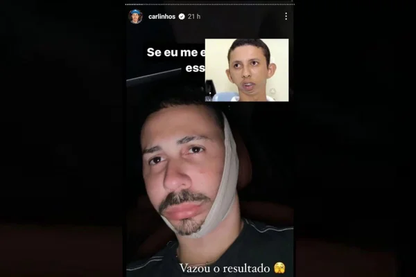 homem com pano ao redor do queixo