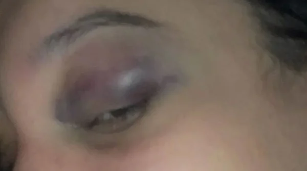 Mulher é agredida no Jockey Club do Rio