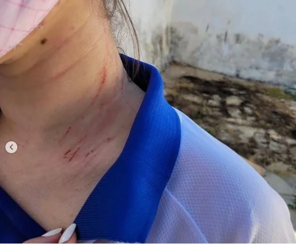 goias jovem agredida pelo pai