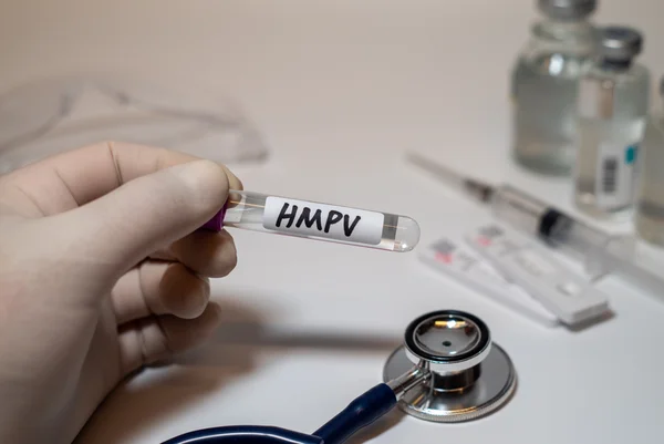 Imagem ilustrativa mostra kit RT-PCR do metapneumovírus humano (HMPV), conceito de saúde médica. China saúde