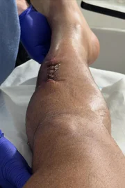 Vittor Fernando publicou registros do hospital e do carro atingido após atentado Vittor Fernando publicou registros do hospital e do carro atingido após atentado