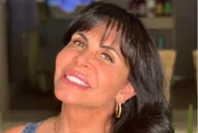 Gretchen raspou a cabeça por opção, mas técnicas modernas de transplante permitem fazer a cirurgia mantendo os fios longos