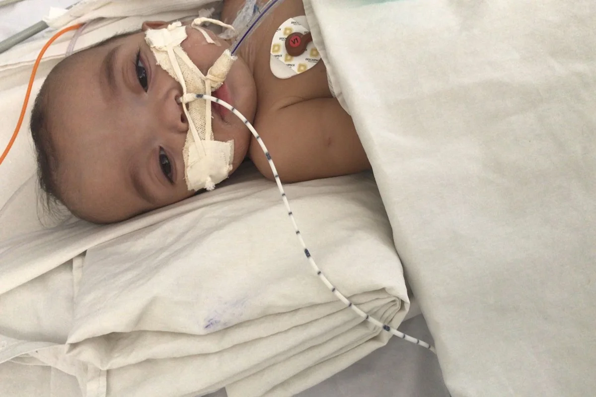 A menina nasceu prematura de 28 anos A menina nasceu prematura de 28 anos