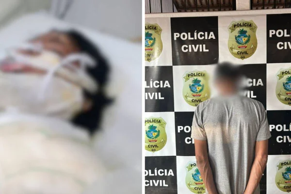 imagem colorida mulher queimada pelo companheiro goias