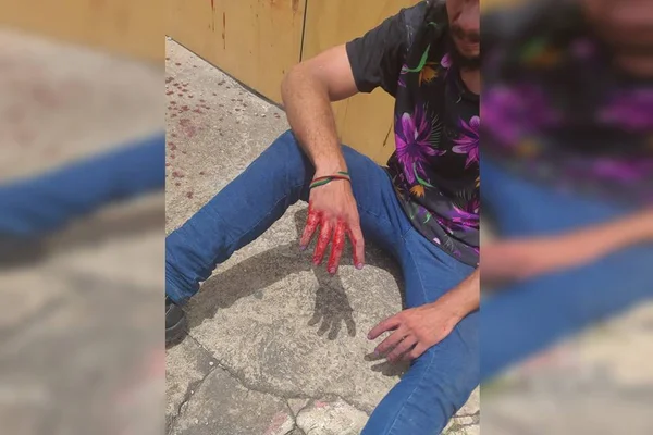Homem leva facada durante briga na Rodoviária do Plano Piloto