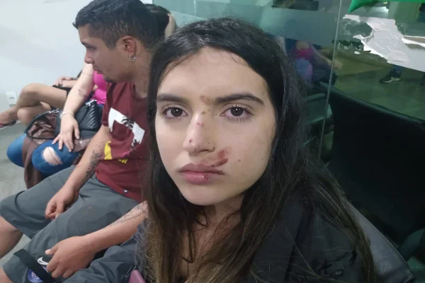 Menina com rosto ensanguentado