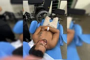 Rafael, que veio de Goiânia apenas para o evento, relata ter pensado que não sobreviveria ao ataque