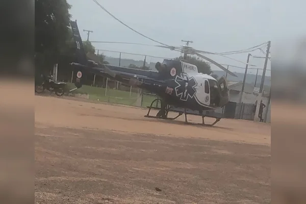 Bebê de 1 ano sofre queimaduras de segundo grau com caldo de feijão