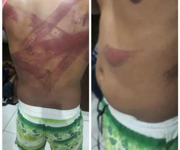 Fazenda agredido