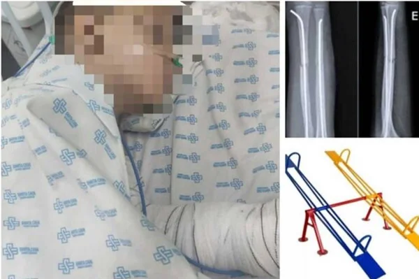 Imagem mostra Criança fraturou braço em brinquedo de escola em Campo Grande - Metrópoles