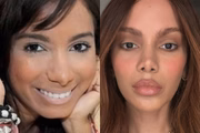 Médica detalha procedimentos realizados por Anitta e fala de excessos