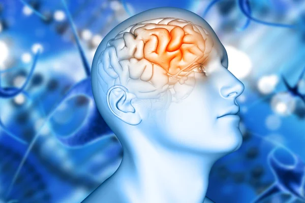 Ilustração colorida, em tons azuis, brancos e laranjas, de silhueta umana com ênfase da imagem no cérebro danificado pelo alzheimer - Metrópoles.