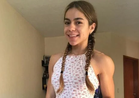 Influenciadora fitness morre após cirurgia para reduzir suor